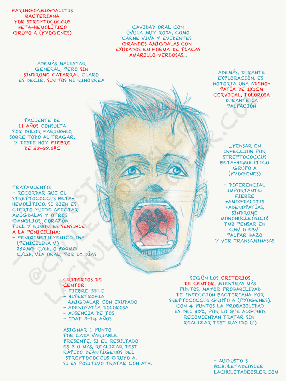 Faringitis bacteriana