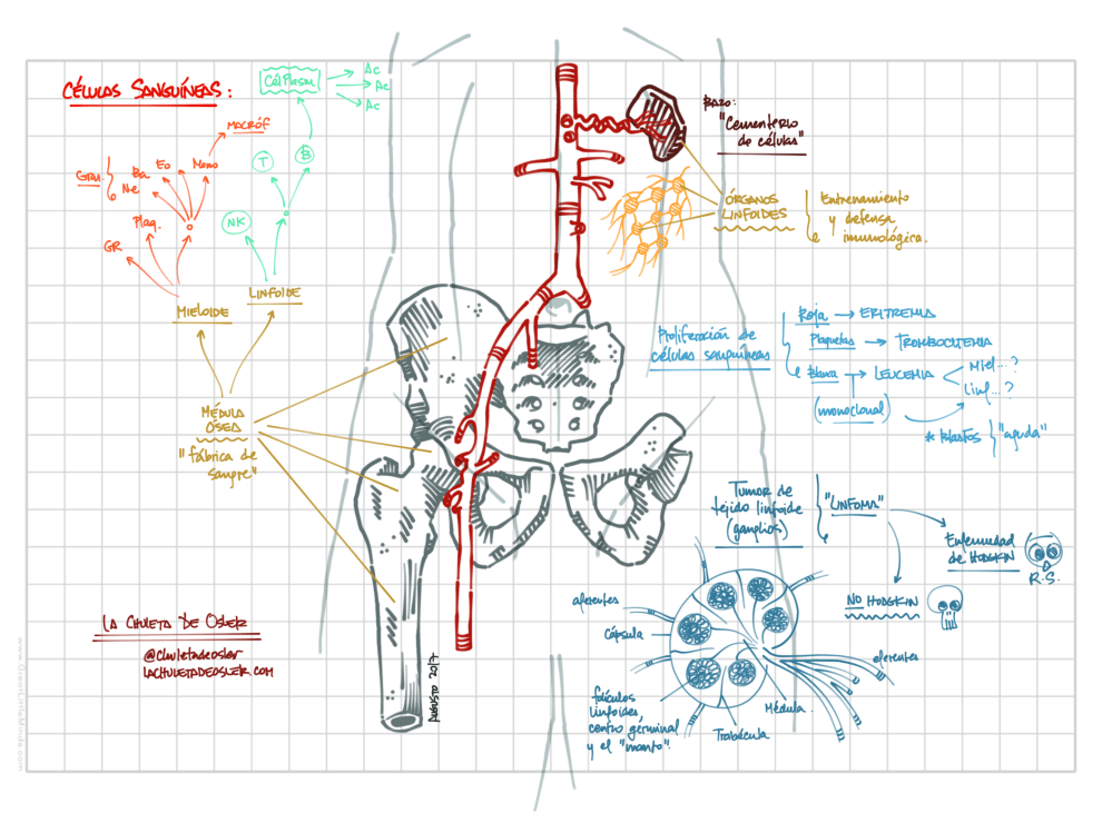 Leucemias y linfomas